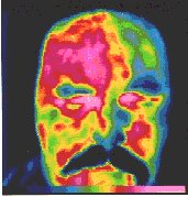 Infrared Thermography headache.jpg (11136 bytes)